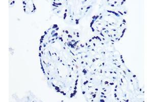 Immunohistochemistry (IHC) image for anti-ATP-Dependent RNA Helicase A (DHX9) antibody (ABIN7265747)