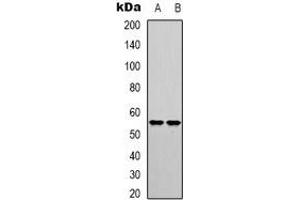 Western blot analysis of IRF3 (pS385) expression in HEK293T (A), HT29 (B) whole cell lysates.