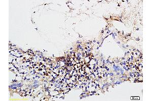 Formalin-fixed and paraffin embedded rabbit sclera tissue labeled with Rabbit Anti-CD31/PECAM-1 Polyclonal Antibody (ABIN726140) at 1:600 followed by conjugation to the secondary antibody and DAB staining. (CD31 Antikörper  (AA 681-738))