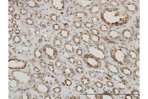 Immunostaining (ISt) image for anti-Mitogen-Activated Protein Kinase-Activated Protein Kinase 2 (MAPKAPK2) (AA 302-400) antibody (ABIN563999)