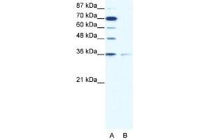 ZNF326 antibody (20R-1071) used at 0. (ZNF326 Antikörper  (C-Term))