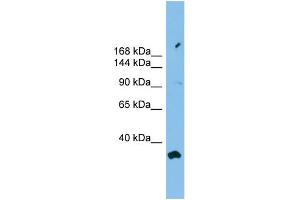WB Suggested Anti-PACS2 Antibody Titration: 0. (PACS2 Antikörper  (Middle Region))