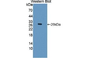Western blot analysis of the recombinant protein. (HES1 Antikörper  (AA 21-251))