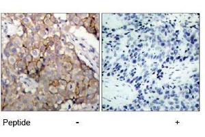 Image no. 1 for anti-Epidermal Growth Factor Receptor (EGFR) (Tyr1092) antibody (ABIN197230) (EGFR Antikörper  (Tyr1092))