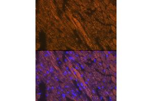 Immunofluorescence analysis of mouse heart cells using Cardiac troponin T (TNNT2) Rabbit pAb (ABIN3021485, ABIN3021486, ABIN3021487 and ABIN6215132) at dilution of 1:100 (40x lens). (Cardiac Troponin T2 Antikörper  (AA 1-120))