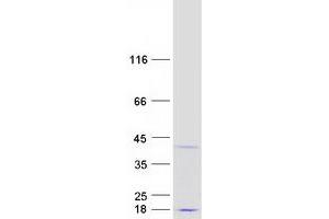 Western Blotting (WB) image for Coiled-Coil Domain Containing 106 (CCDC106) protein (Myc-DYKDDDDK Tag) (ABIN2713278)