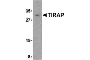 Western blot analysis of TIRAP in MCF-7 cell lysate with this product at 4 μg/ml.