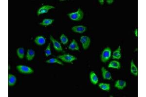 Immunofluorescent analysis of A549 cells using ABIN7170577 at dilution of 1:100 and Alexa Fluor 488-congugated AffiniPure Goat Anti-Rabbit IgG(H+L) (S1PR5 Antikörper  (AA 309-398))