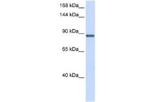 INTS6 antibody used at 1 ug/ml to detect target protein. (INTS6 Antikörper  (C-Term))