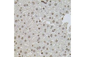 Immunohistochemistry of paraffin-embedded mouse liver using ZNF408 antibody. (ZNF408 Antikörper  (AA 471-720))