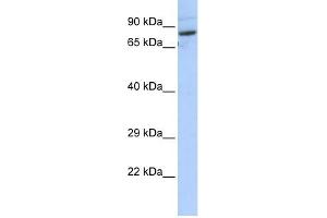 SPTLC2 antibody used at 1 ug/ml to detect target protein. (SPTLC2 Antikörper  (N-Term))