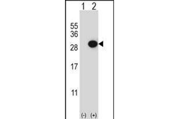 CTHRC1 Antikörper  (N-Term)