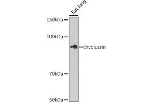 Western blot analysis of extracts of Rat lung cells, using Involucrin antibody (ABIN6128025, ABIN6141815, ABIN6141818 and ABIN7101419) at 1:500 dilution. (Involucrin Antikörper)