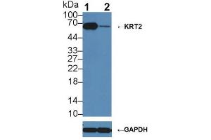 Western blot analysis of (1) Wild-type A431 cell lysate, and (2) KRT2 knockout A431 cell lysate, using Rabbit Anti-Rat KRT2 Antibody (1 µg/ml) and HRP-conjugated Goat Anti-Mouse antibody ( (Keratin 2 Antikörper  (AA 368-507))