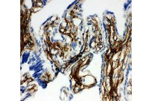IHC-F testing of COL1A1 antibody and human placenta tissue