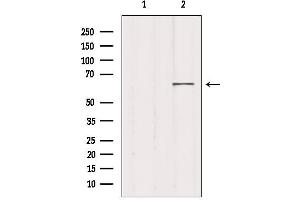 Western blot analysis of extracts from 293, using MED26 Antibody. (MED26 Antikörper  (N-Term))