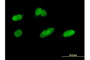 Immunofluorescence of monoclonal antibody to CDC2L2 on HeLa cell.