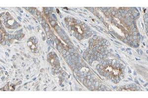 ABIN6276497 at 1/100 staining Human prostate tissue by IHC-P. (AMBRA1 Antikörper  (C-Term))