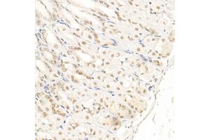 Immunohistochemistry of paraffin-embedded mouse stomach using SOCS1 Rabbit mAb (ABIN7270640) at dilution of 1:100 (40x lens). (SOCS1 Antikörper)