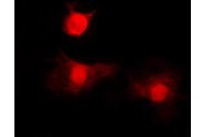 Immunofluorescent analysis of Histone Deacetylase 8 (pS39) staining in A549 cells.