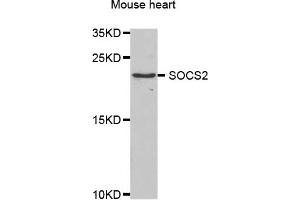 Western blot analysis of extracts of mouse heart, using SOCS2 antibody.