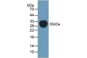 Detection of Recombinant Pgp, Mouse using Polyclonal Antibody to Permeability Glycoprotein (Pgp) (Permeability Glycoprotein Antikörper  (AA 391-627))