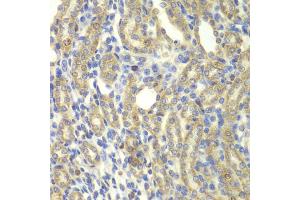 Immunohistochemistry of paraffin-embedded rat kidney using KBTBD7 antibody (ABIN5975133) at dilution of 1/100 (40x lens). (KBTBD7 Antikörper)