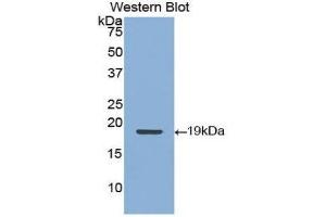 Western Blotting (WB) image for anti-Keratin 9 (KRT9) (AA 315-456) antibody (ABIN3208415) (KRT9 Antikörper  (AA 315-456))
