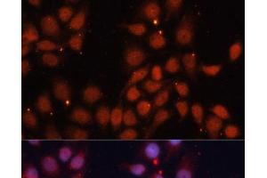 Immunofluorescence analysis of HeLa cells using CDK11B Polyclonal Antibody at dilution of 1:100. (CDK11 Antikörper)