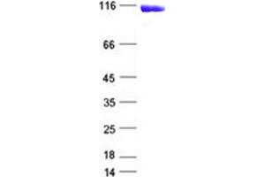 Validation with Western Blot