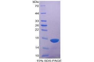 SDS-PAGE analysis of Human ADAMTS1 Protein.
