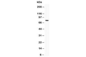 Western blot testing of hCG receptor antibody and MCF-7 lysate (hCG Receptor (N-Term) Antikörper)