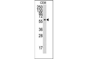 Western blot analysis of anti-YARS Antibody (C-term) in CEM cell line lysates (35ug/lane). (YARS Antikörper  (C-Term))