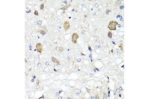 Immunohistochemistry of paraffin-embedded rat brain using RBP2 antibody. (RBP2 Antikörper  (AA 1-134))