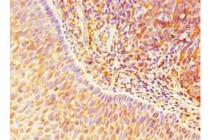 Immunohistochemistry of paraffin-embedded human tonsil tissue using ABIN7172265 at dilution of 1:100 (TLR1 Antikörper  (AA 20-270))