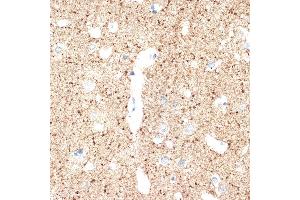 Immunohistochemistry of paraffin-embedded human brain using V Rabbit mAb (ABIN7271312) at dilution of 1:100 (40x lens). (VAMP1 Antikörper)