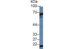 Western blot analysis of Mouse Testis lysate, using Mouse DKC Antibody (1 µg/ml) and HRP-conjugated Goat Anti-Rabbit antibody ( (DKC1 Antikörper  (AA 298-509))