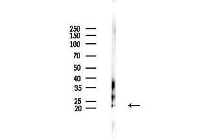 anti-Complexin 3 (CPLX3) (N-Term) antibody