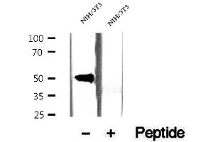 Western blot analysis of extracts of NIH/3T3 cells, using CREST antibody. (SS18L1 Antikörper)