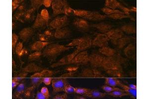 Immunofluorescence analysis of C6 cells using PTCH1 Polyclonal Antibody at dilution of 1:100. (Patched 1 Antikörper)