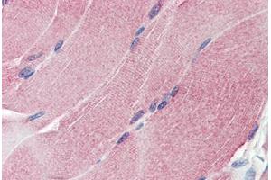Human Skeletal Muscle (formalin-fixed, paraffin-embedded) stained with THBS1 antibody ABIN337292 at 10 ug/ml followed by biotinylated anti-mouse IgG secondary antibody ABIN481714, alkaline phosphatase-streptavidin and chromogen. (Thrombospondin 1 Antikörper  (Collagen-binding Domain))