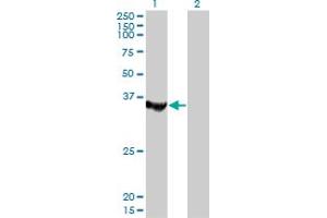 Western Blot analysis of MTMR1 expression in transfected 293T cell line by MTMR1 monoclonal antibody (M01), clone 1F10.