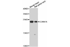 Western blot analysis of extracts of various cell lines, using CDKN1A antibody (ABIN5970693) at 1/1000 dilution. (p21 Antikörper)