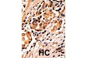 Immunohistochemistry (Paraffin-embedded Sections) (IHC (p)) image for anti-BCL2-Associated Agonist of Cell Death (BAD) (pSer75) antibody (ABIN389520)