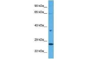 Host:  Rabbit  Target Name:  KL  Sample Tissue:  Human Jurkat Whole Cell  Antibody Dilution:  1ug/ml (Klotho Antikörper  (N-Term))