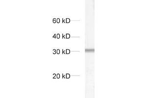 dilution: 1 : 1000, sample: crude synaptosomal fraction of rat brain (P2) (Syntaxin 6 Antikörper  (AA 1-235))