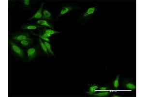 Immunofluorescence of purified MaxPab antibody to EPB41L2 on HeLa cell. (EPB41L2 Antikörper  (AA 1-633))