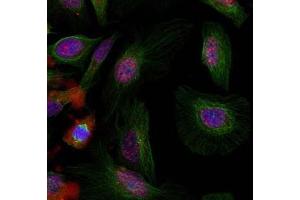 Image no. 3 for anti-Mdm2, p53 E3 Ubiquitin Protein Ligase Homolog (Mouse) (MDM2) (pSer166) antibody (ABIN401610) (MDM2 Antikörper  (pSer166))