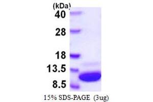 S100 Calcium Binding Protein A1 (S100A1) (AA 1-94) protein (His tag)