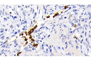 Immunohistochemistry (IHC) image for anti-Caspase 1 (CASP1) (AA 120-297) antibody (ABIN7433831)